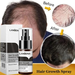 Tinh chất kích thích mọc tóc ngăn ngừa hói đầu LANBENA dạng xịt