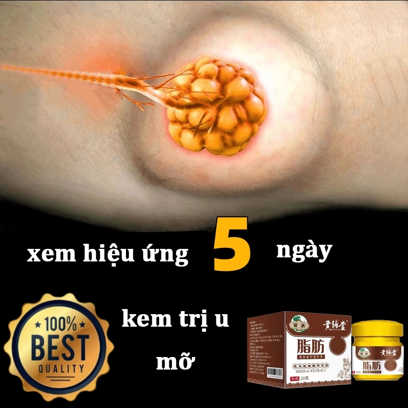 Kem tan u mỡ Kem tan mỡ Kem lipoma 20g Kem tan mỡ chính hãng cho nhiều cục u dưới da đơn lẻ u tuyến