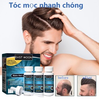 Hotwind 1 Lọ/6 Lọ 60ml Minoxidil 5% Kirkland,Tinh chất mọc tóc mọc râu,Dung dịch thoa ngoài kích mọc tóc, mọc Râu Tóc Nhanh