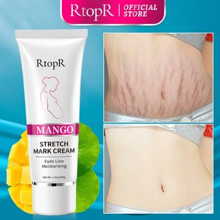 RtopR Xoài Xóa Sẹo Mang Thai Kem Rạn Da Kem Làm Săn Chắc Cơ Thể 40g