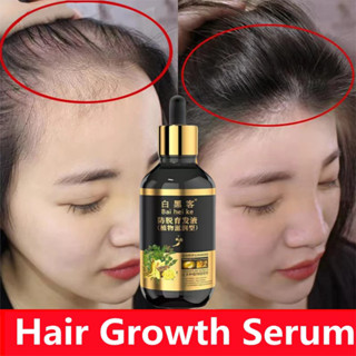  Thuốc cổ truyền theo toa. Tăng trưởng tóc Chống rụng tóc 30ml mọc tóc Thúc đẩy tóc dày hơn và mọc lại tóc cho nam nữ Nuôi dưỡng da đầu hai 