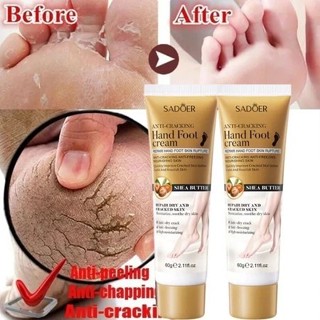 kem bôi chân kem nứt gót chân Kem dưỡng chân tay 60g Loại bỏ da chết ở tay chân, Chữa nứt nẻ da tay chân hiệu quả ,Giữ ẩm cho làn da trắng và mềm mại ở tay chân