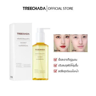  Thái Lan TREECHADA Dừa Làm Sạch Dầu Mắt Môi Mặt Nhẹ Nhàng Làm Sạch Sâu Yếu Da Nhạy Cảm Tẩy Trang Kem Dưỡng Da 