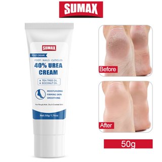  40% Urea Cream Kem dưỡng da chân & tay Kem phục hồi gót chân chống trầy xước Da chết Kem dưỡng ẩm tay-cho khô Cracked Dưỡng ẩm & Rehydratr cho bàn chân và bàn tay 50g 