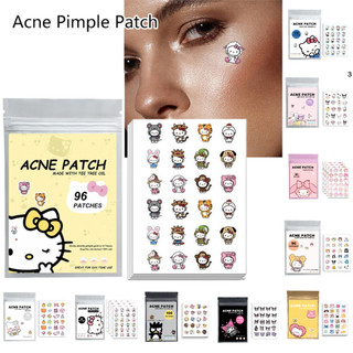  NEW Làm Đẹp 96 Cái   100 Chiếc Hello Kitty Mèo Sửa Chữa Mụn Miếng Dán Chăm Sóc Da Mặt Phai Màu Chảy Máu Dấu Vết Mụn 