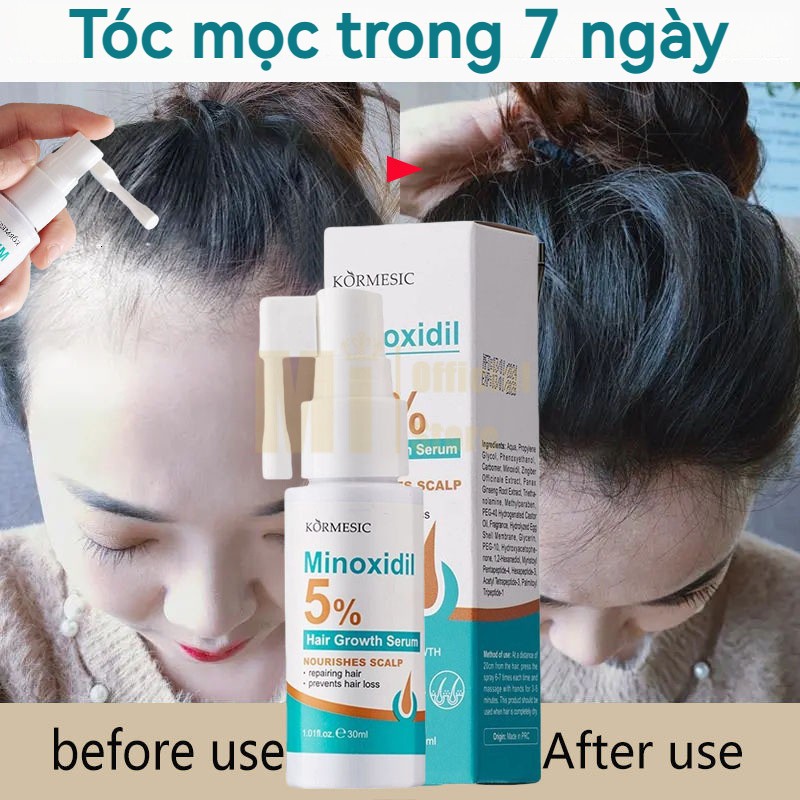 Xịt mọc tóc Minoxidil 5% Xịt mọc tóc nhanh Chống rụng tóc Chăm sóc tóc 30ml dành cho nam và nữ Giảm 