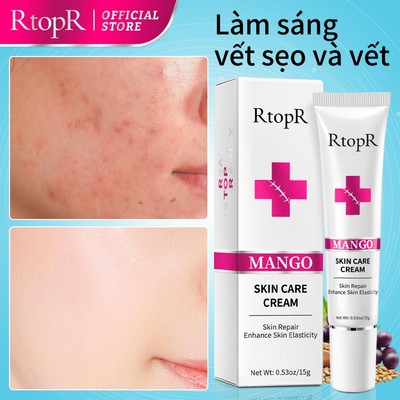 Rtopr kem dưỡng da xoài làm trắng và dưỡng ẩm chăm sóc da 15g