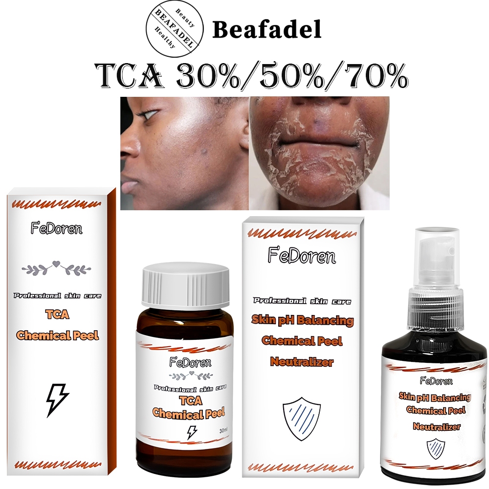 TCA Hóa Học Peel 50% 20% Axit TCA Cho Da Đậm Làm Mềm Cơ Thể Lột Da Chết Dưỡng Ẩm Tẩy Tế Bào Chết