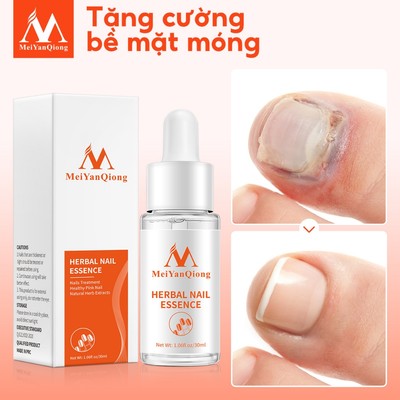 MeiYanQiong Tinh Chất Trị Nấm Móng Tay / Chân Loại Bỏ Nấm Móng 30ml