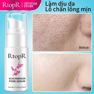RtopR Tinh chất phục hồi lỗ chân lông Glycyrrhiza 20ml