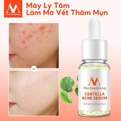 MeiYanQiong Serum hỗ trợ trị Mụn Trứng Tinh Chất Rau Má MeiYanQiong Kiềm Dầu Và Dưỡng Ẩm 10ml