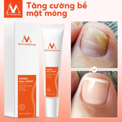 MeiYanQiong Kem Hỗ Trợ Giảm Bệnh Nấm Móng 15g