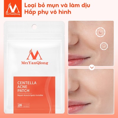 Meiyanqiong Miếng dán lột mụn đầu đen Sửa chữa và làm sạch sâu da mặt 24 viên