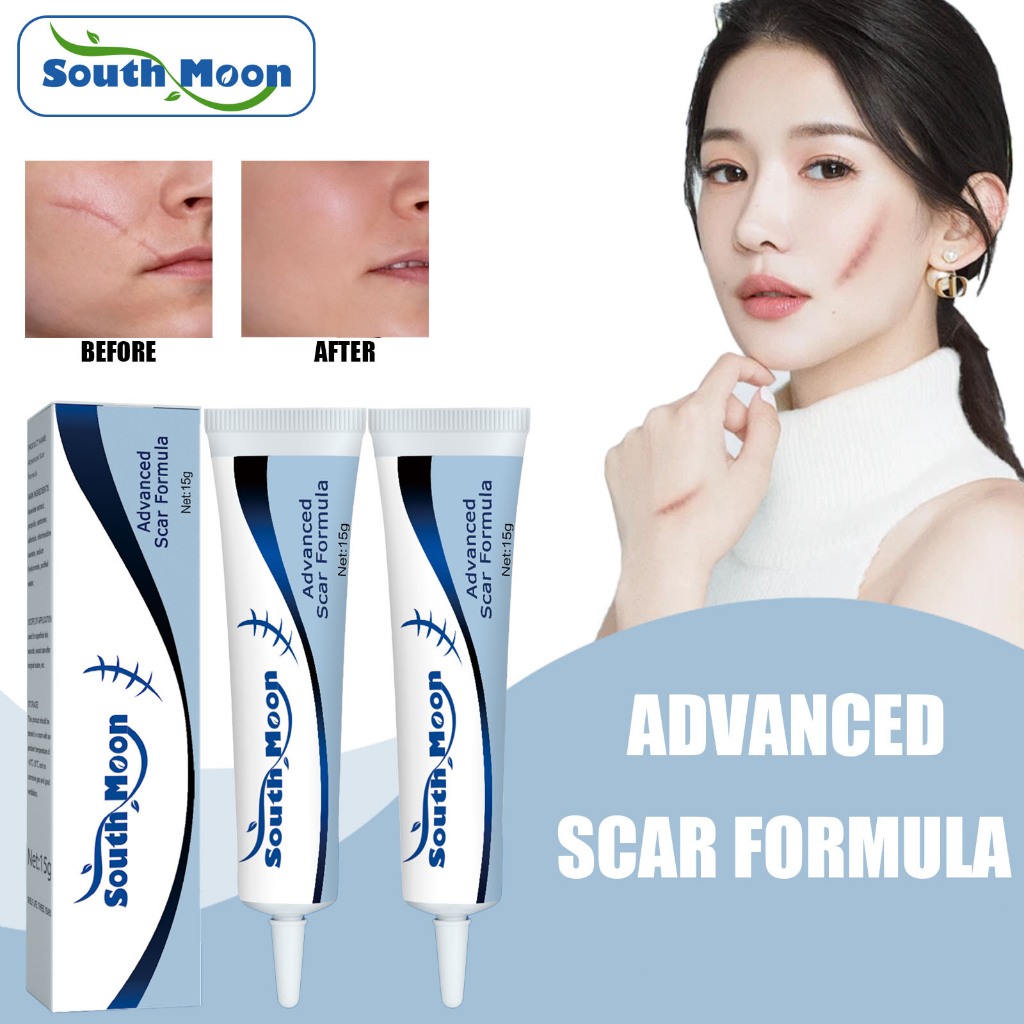 Gel tẩy sẹo mặt trăng Nam 15g Loại bỏ vết cắn muỗi / Scar Keloid Scar / Scar Old Scar / Black Scar /