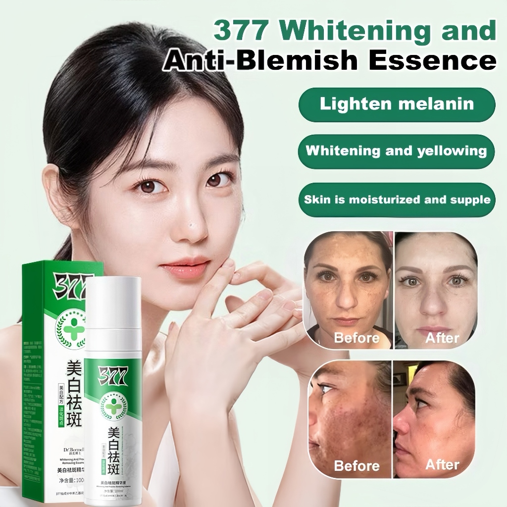 【 Nói lời tạm biệt với vết thâm 】 Tinh chất Niacinamide làm trắng da 377 / 377 ◈ ❈ ❈ ❈ ❈ ❈ ❈ ❈ ❈ ❈ X