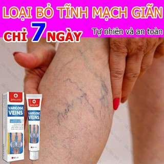 Kem Giãn Tĩnh Mạch,Cải Thiện Lưu Thông Máu Giữ Lại Vẻ Đẹp Cho Đôi Chân
