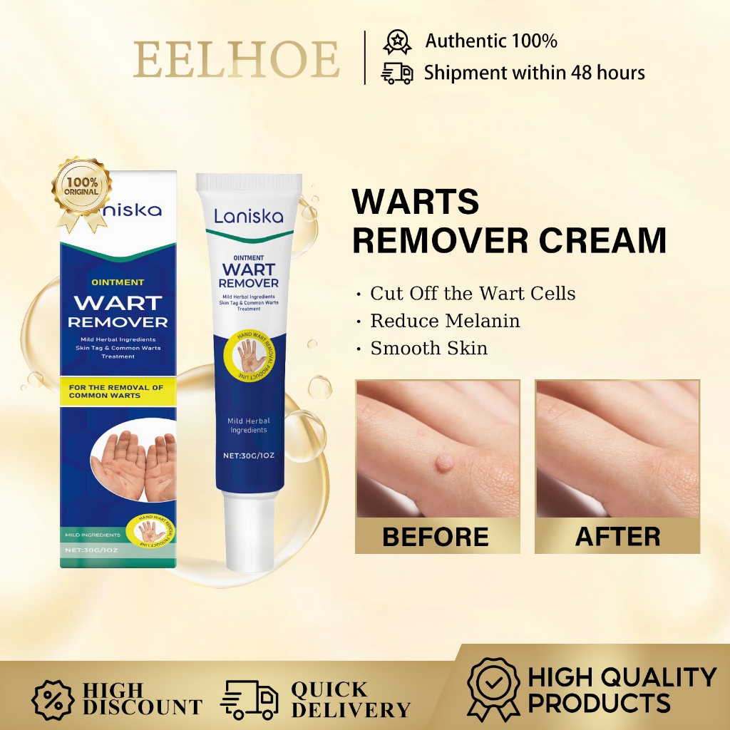 Laniska Skin Tags Mole Remover Warts Remover Cream 30g Hand Warts, Corn Skin Tag Warts Remover