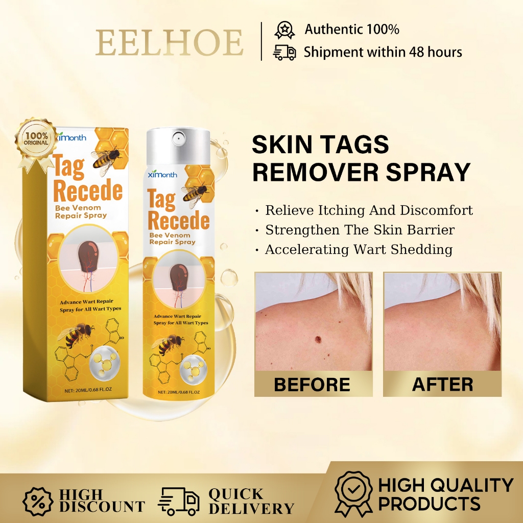Ximonth Skin Tags Remover Spray 20ML Mole Skin Dark Spot Warts Remover Serum Tàn nhang Face Wart Tag