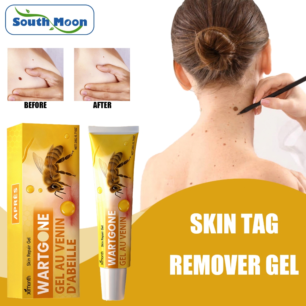 Ximonth Warts Remover Skin Tag & Mole Remover Gel - Công thức tự nhiên nguyên bản để loại bỏ mụn cóc