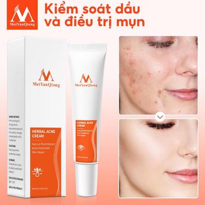 MeiYanQiong Kem dưỡng Hỗ Trợ Giảm Mụn cải thiện da thô ráp xỉn màu làm sáng màu da 15g