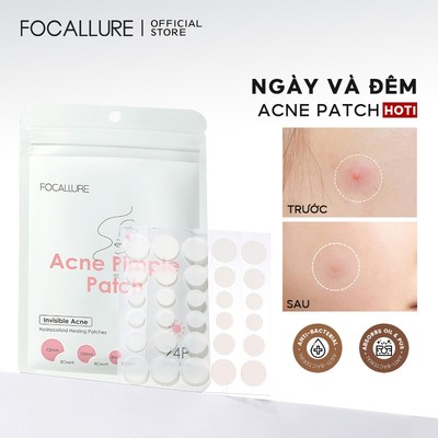 Miếng dán mụn FOCALLURE 2g tái tạo chăm sóc da tiện dụng cao cấp