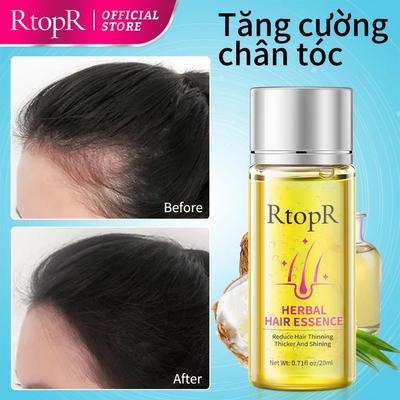 RtopR Tinh dầu thảo dược dưỡng da đầu, nuôi dưỡng chân tóc giúp tóc dày chắc, tinh chất chăm sóc tóc thưa yếu