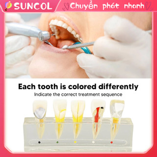 SUNCOL Nha khoa Bột giấy Khoang Mô hình Bệnh viện Nhựa Nội nha Răng để Thực hành Giảng dạy Màn