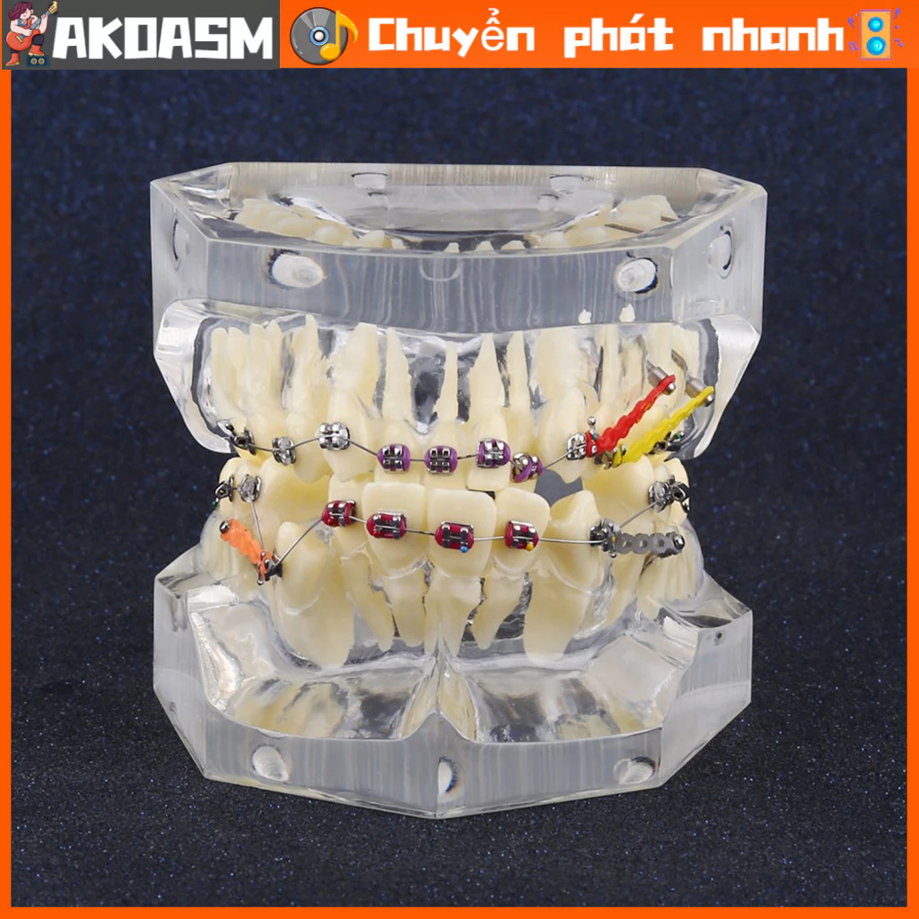 Điều trị chỉnh nha khoa Nghiên cứu sai lệch mô hình răng với chuỗi dây AKOASM