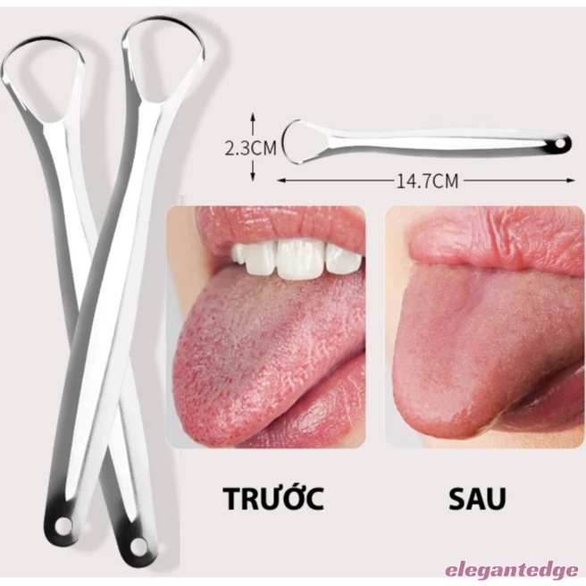 💟Elegant💟Dụng Cụ Cạo Lưỡi Dụng Cụ Vệ Sinh Lưỡi Inox Cao Cấp Loại Bỏ Vi Khuẩn Giảm Hôi Miệng Tăng Vị Giác 100%