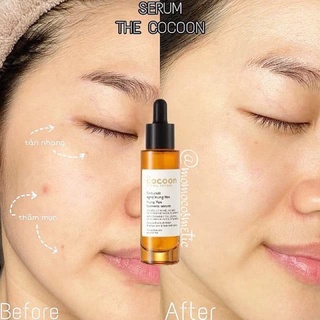 Tinh chất nghệ Hưng Yên Cocoon