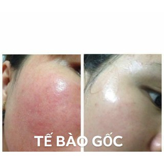 Tế bào gốc ginsenoside hugi - chiết xuất từ nhân sâm hàn quốc