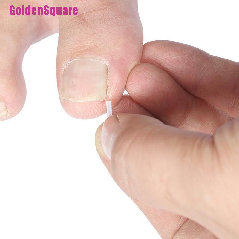 Bộ 10 Miếng Đệm Chỉnh Hình Móng Tay Chuyên Dụng
