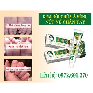 Kem Bôi Nứt Nẻ, Á Sừng, Khô Da, Ngứa Tay Chân Ngoài Da