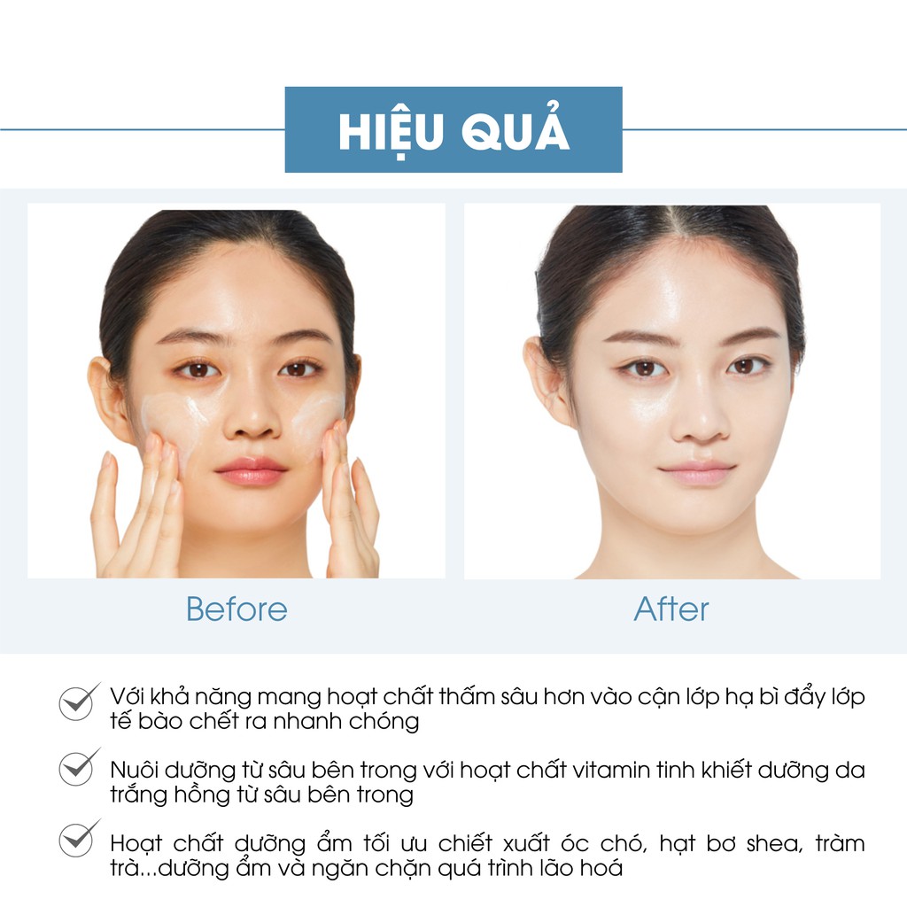 Bộ làm sạch và dưỡng trắng da mặt Truesky gồm 1 kem dưỡng trắng da mặt 20g + 1 tẩy tế bào chết da mặt 50g | BigBuy360 - bigbuy360.vn