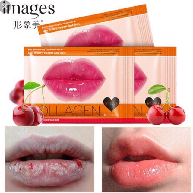 Combo 10 Mặt nạ Môi Collagen Nourish Lips Membrane