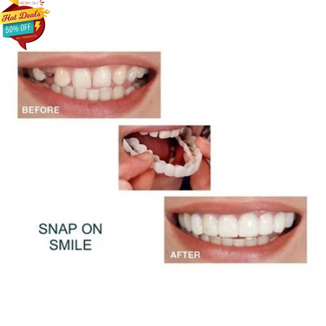 Bộ 2 bọc răng trắng có thể tái sử dụng