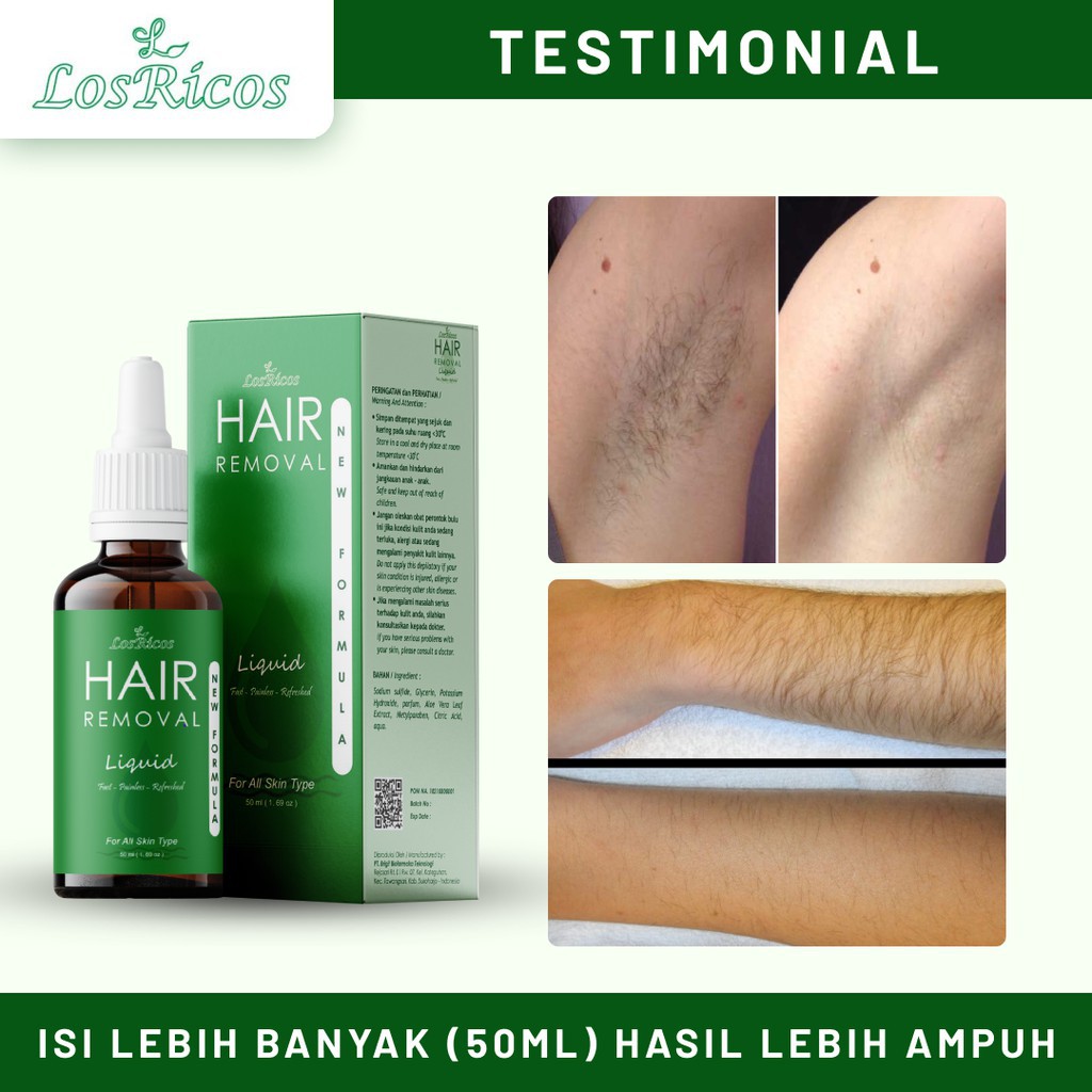 (Hàng Mới Về) Máy Triệt Lông Vĩnh Viễn An Toàn Và Hiệu Quả | BigBuy360 - bigbuy360.vn