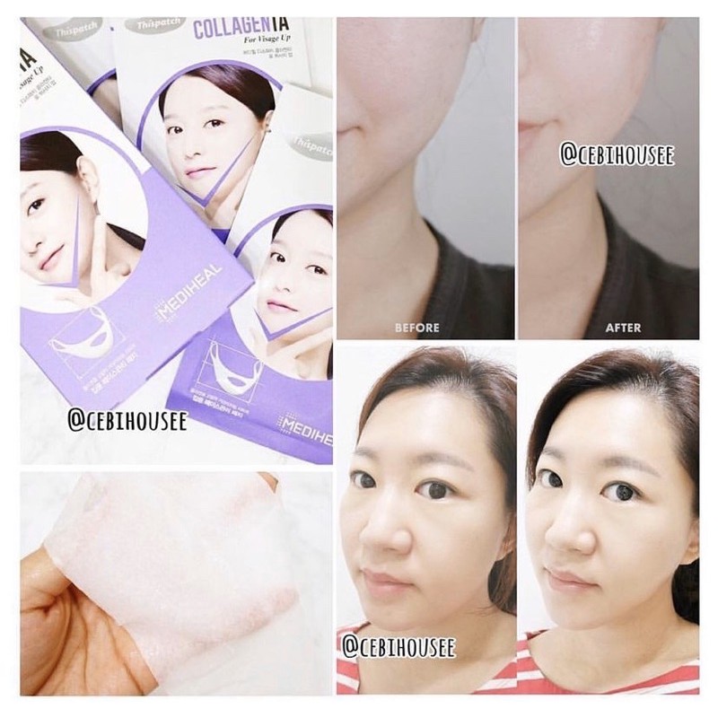 [SALE] Mặt nạ giấy Mediheal các loại | Thế Giới Skin Care