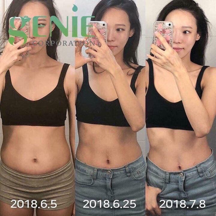 VIÊN HUỶ MỠ BỤNG GENIE DEMAR87 BELLY HÀN QUỐC | BigBuy360 - bigbuy360.vn