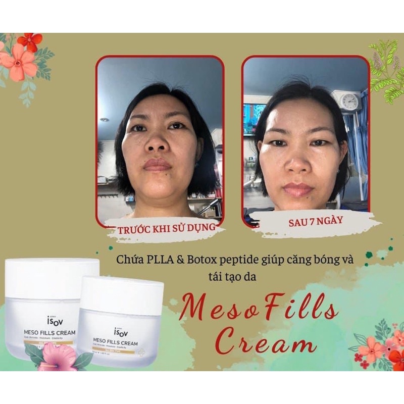 MESO FILLS CREAM - Kem Chứa PLLA & Botox Giúp Tái Tạo Và Căng Bóng Da