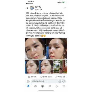 Tinh chất serum trắng da Honesi