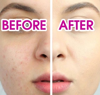 Kem chống nắng  BB Cream