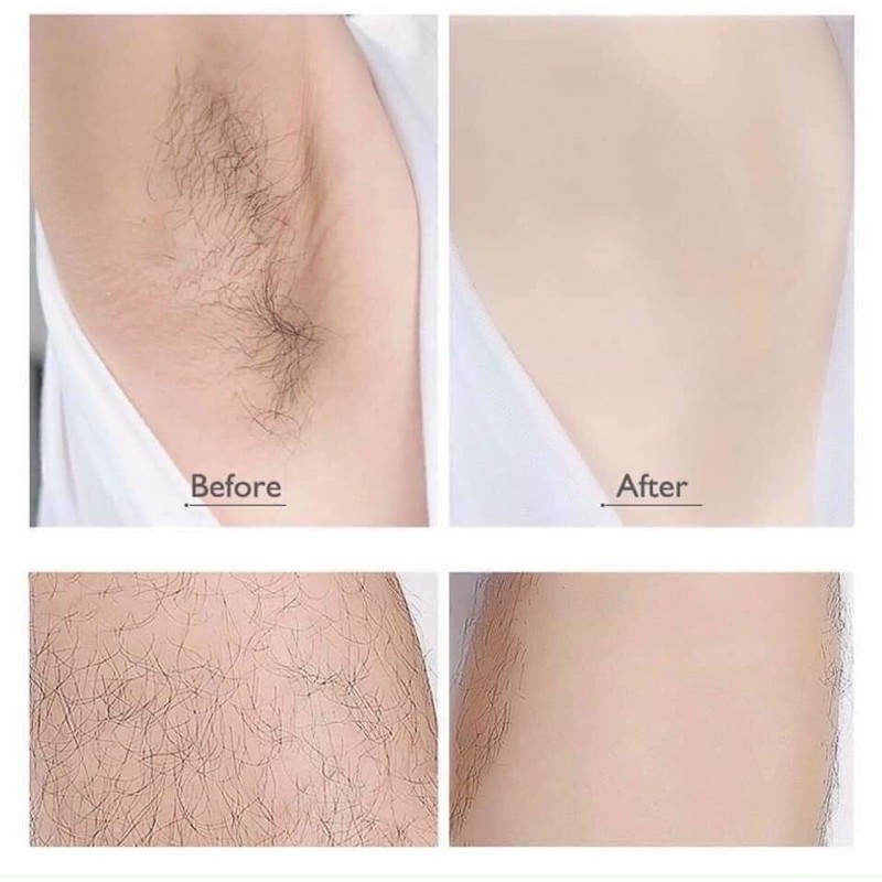 Kem xịt tẩy lông Detvfo 150ml tẩy lông chân nách chân tay vùng kín cho nam nữ cho da nhạy cảm Cleo Velvet Queen Beauty | BigBuy360 - bigbuy360.vn