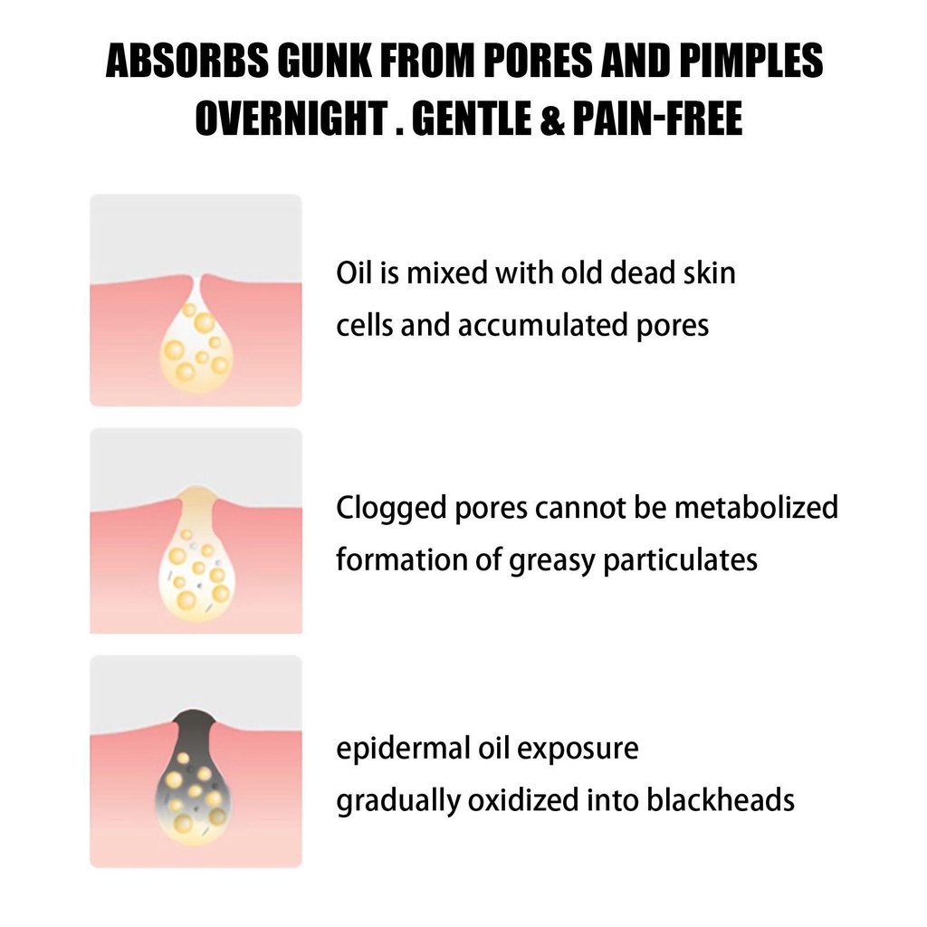 Bộ 10 Mặt Nạ Bùn Khoáng Lột Mụn Đầu Đen Cho Mũi