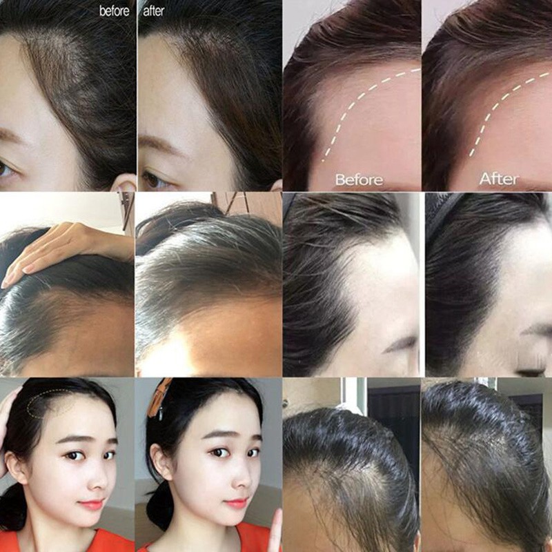 [Hàng mới về] Phấn che khuyết điểm tóc thưa Sevich với 7 màu sắc tùy chọn tự nhiên