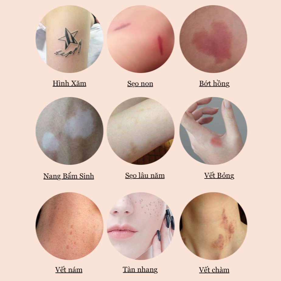 Kem che xăm che khuyết điểm tạm thời Tattoo chính hãng chống nước hiệu quả, che hoàn toàn hình xăm đậm màu | BigBuy360 - bigbuy360.vn