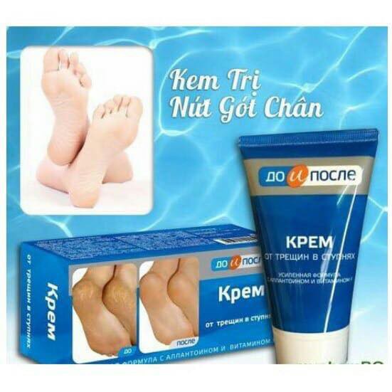 Kem Ngăn Ngừa Và Hồi Phục Nứt Nẻ Gót Chân Kpem Nga 50ml