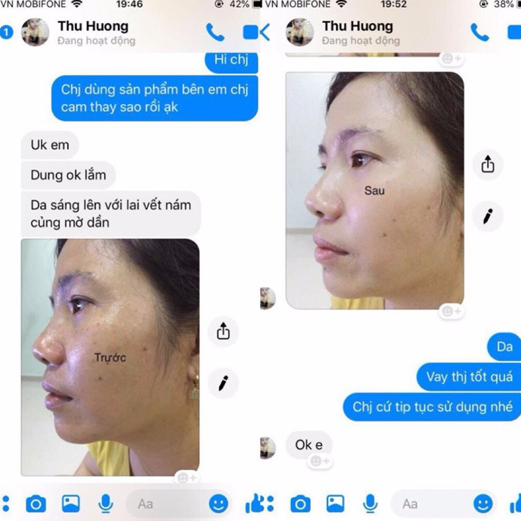 Trọn Bộ Kem Nám Và Tàn Nhang Dưỡng Trắng Da Cao Cấp I'm Nature - An Toàn Cho Cả Mẹ Bầu Và Sau Sinh