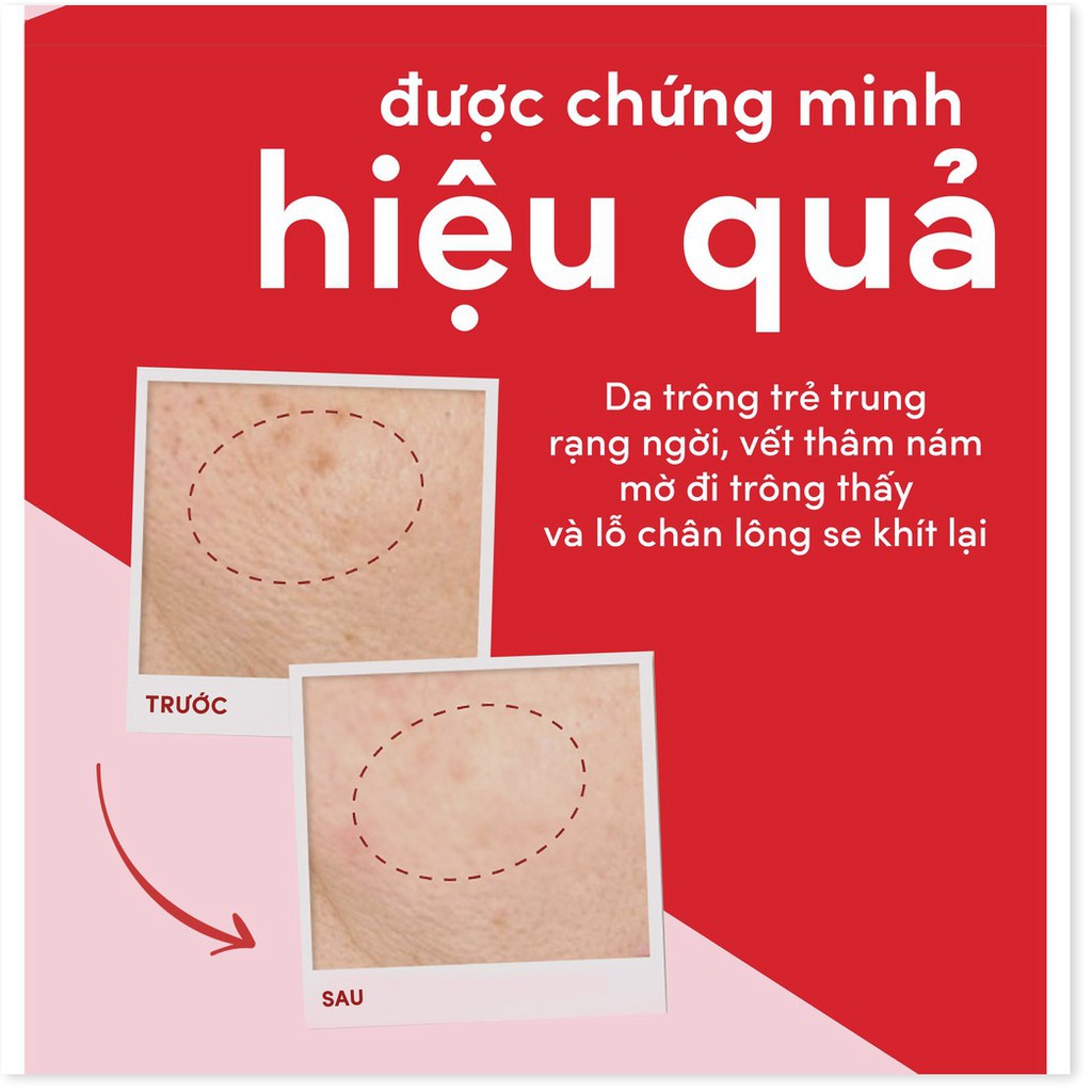 [Mã chiết khấu giảm giá sỉ mỹ phẩm chính hãng] Pond's ngăn ngừa lão hóa kem dưỡng ban đêm 50g