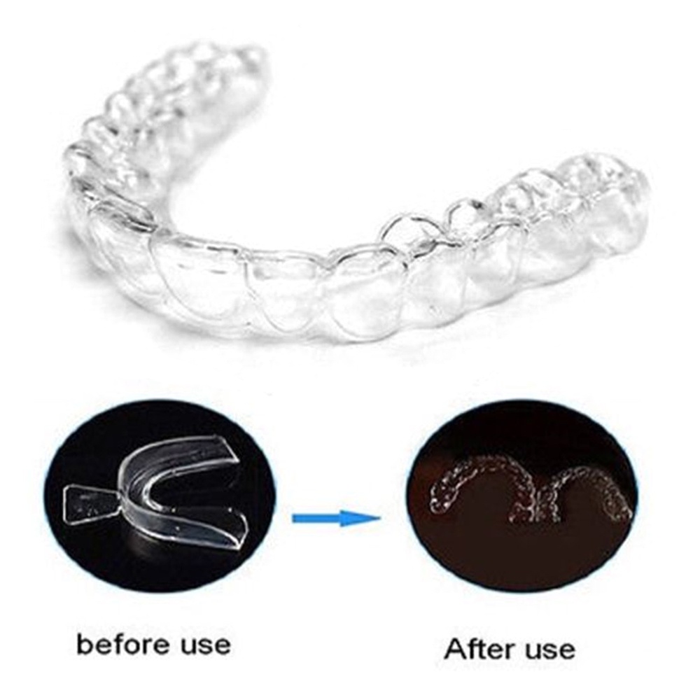 1 Cặp Dụng Cụ Silicone Niềng Răng Tiện Lợi